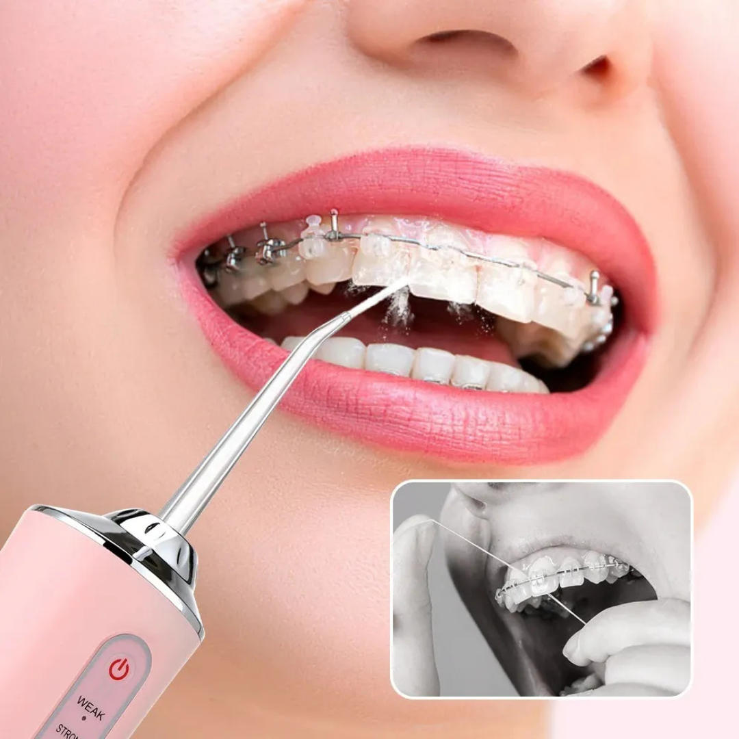 HydroSmile™ – Irrigador Bucal Portátil para una Sonrisa Radiante